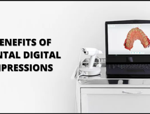 The Benefits of Dental Digital Impressions.