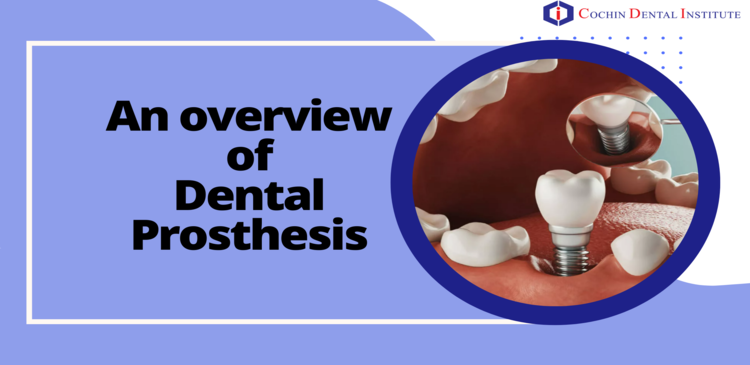 An overview of Dental Prosthesis