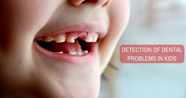 Dental Cavities in Kids; Causes and Prevention