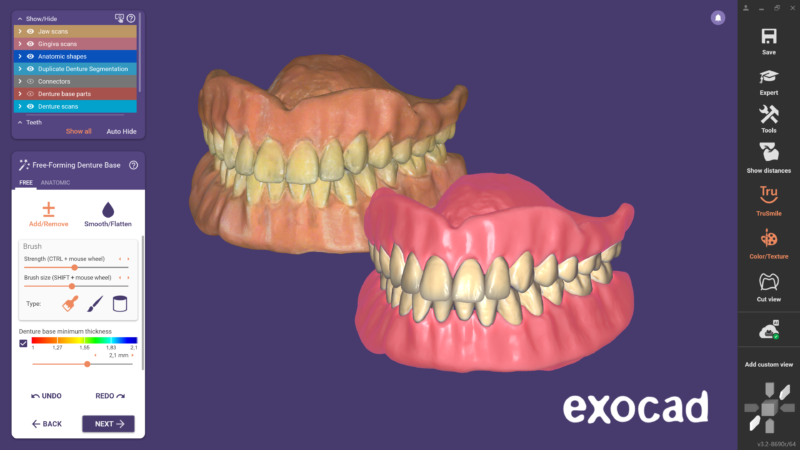 Exocad | Advanced CAD/CAM Software for Digital Dentistry