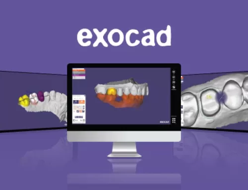 Revolutionize Your Dental Workflows With Exocad