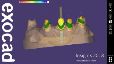 Exocad | Advanced CAD/CAM Software for Digital Dentistry