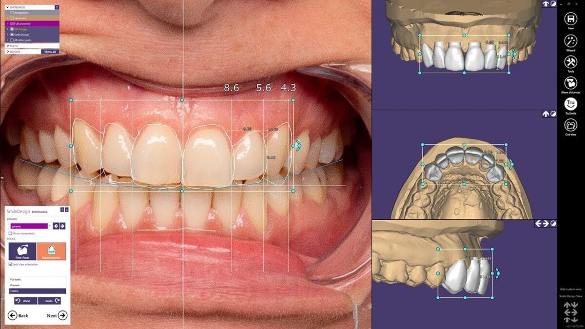 Exocad | Advanced CAD/CAM Software for Digital Dentistry